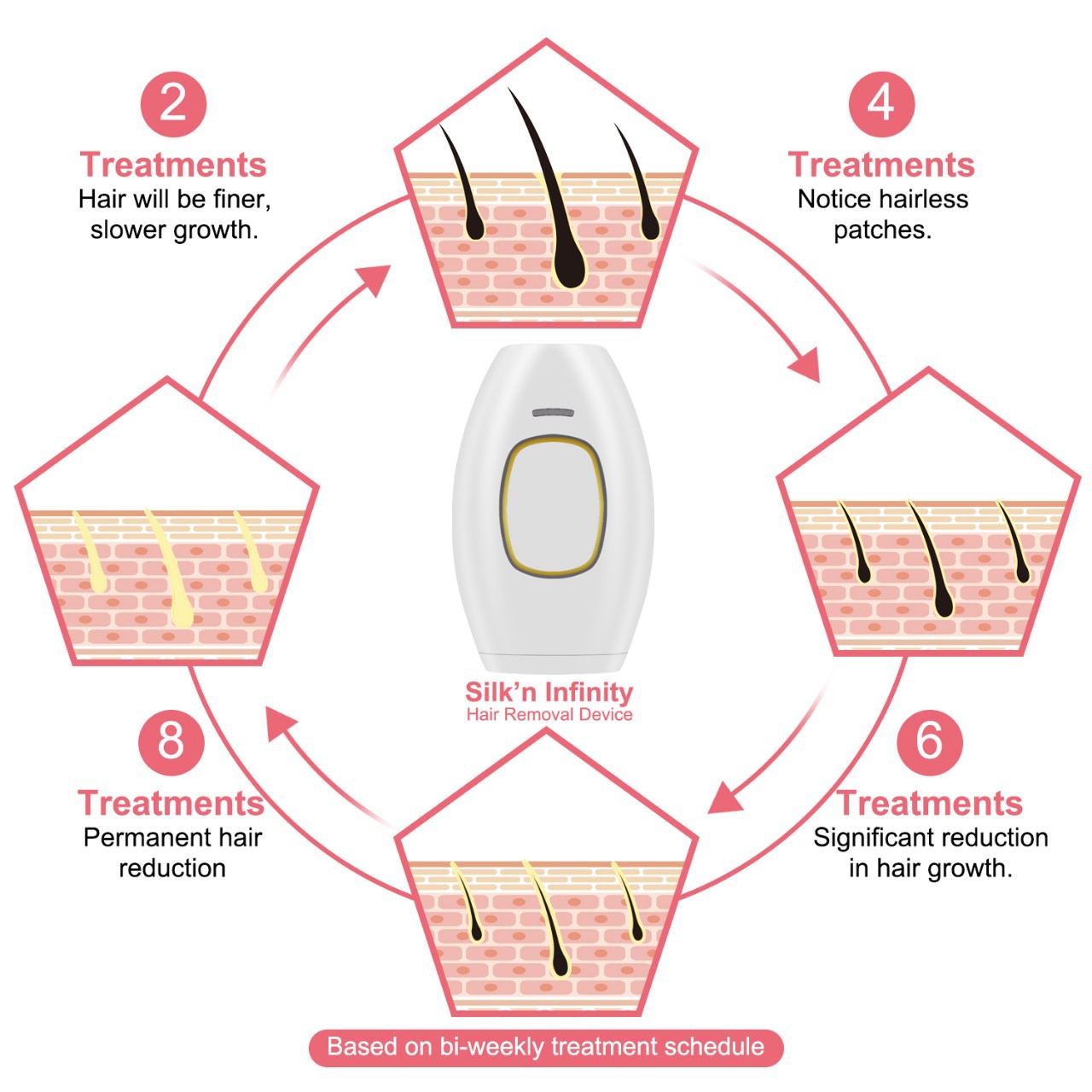 IPL Hair Removal Laser Epilator Women